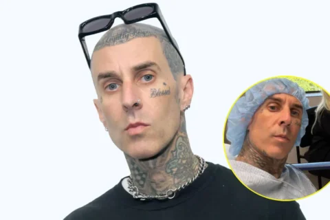 Travis Barker shares pics from hospital; wife Kourtney stays by his side
